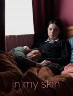 in_my_skin-661952995-msmall.jpg